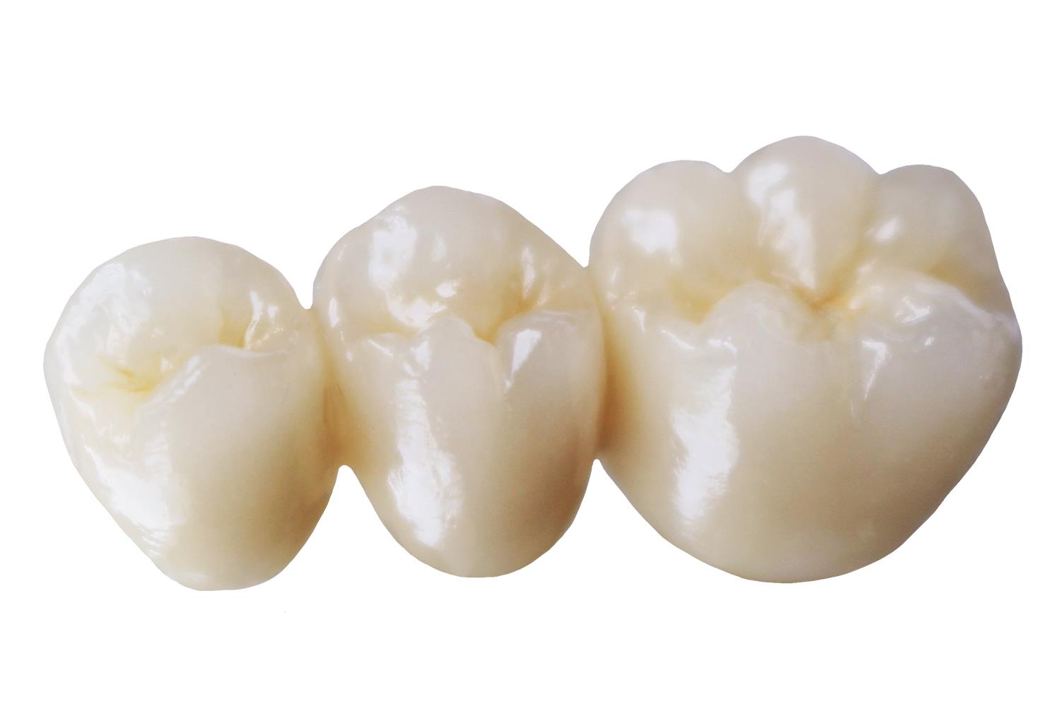 Zirconia-Bridge-2